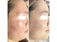 ナチュラリー 佐賀(Naturally)の写真