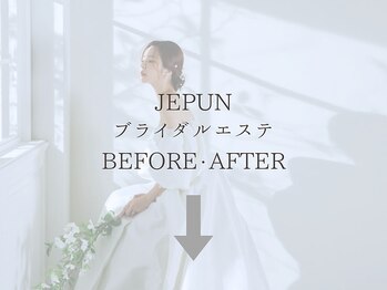 ジュプン 長崎/ブライダルエステ