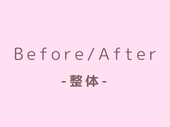 らくだ整骨院/整体Before/After
