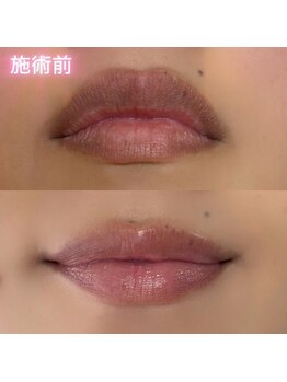 オリ('OLI)/ローマピンク唇