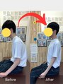 ナオル整体 札幌院(NAORU整体)&nbsp;10代男性、猫背とストレートネックが改善しました！