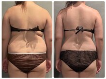 ツーアップ(2up)