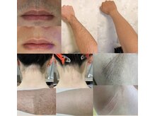 セルフメイド 福井店の雰囲気（ヒゲ、腕、うなじ、脚、ワキのビフォーアフター。全身自由に。）