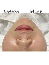 エクスクラメーションマーク(!!!)/片側のみ照射！