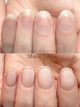 マリーロール 梅田店(Marie Laure)/自爪育成/深爪矯正/ネイルケア