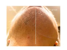 エモベーシック(e'MO BASIC)/モニターさん半顔チャレンジ