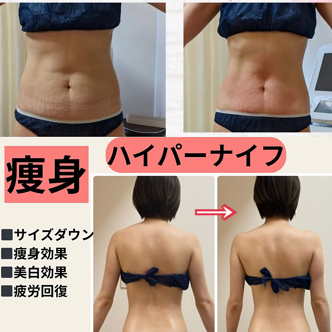 つくば市でEMSが人気のエステサロン｜ホットペッパービューティー