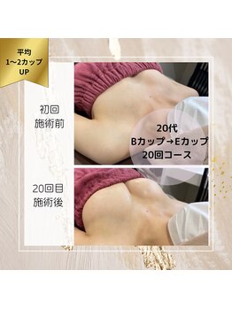 ロココ 町田店(Rococo)/B→Eの3カップUP!