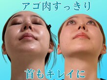 ナチュラルパーフェクトフェイス 新宿