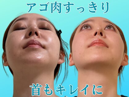 ナチュラルパーフェクトフェイス 新宿の写真