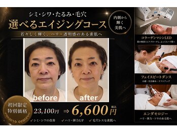 イーズ ミュゼ  ららぽーと横浜店の写真/年齢肌のお悩みにぴったり!目の下のたるみ改善＆リフトUP効果◎『オールエイジングケア体験￥6600』