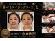 イーズ ミュゼ  ららぽーと横浜店の写真/年齢肌のお悩みにぴったり!目の下のたるみ改善＆リフトUP効果◎『オールエイジングケア体験￥6600』