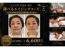 イーズ ミュゼ ららぽーと横浜店