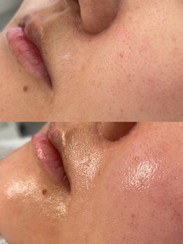 クレア(CLEA)/艶肌