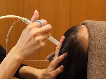 スーパースカルプ 熊本宇城店(SuperScalp)/頭皮洗浄