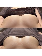 ティグレ 岡山店(TIGRE)/バストアップケア