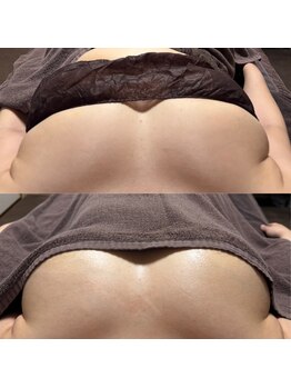 ティグレ 岡山店(TIGRE)/バストアップケア