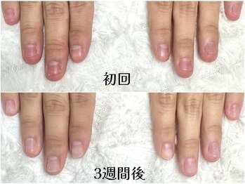 グレースレディ 大阪店/(深爪/長さだし/フィルイン/)