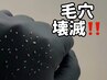ニキビ圧出＋鎮静パック  15,000→11,000