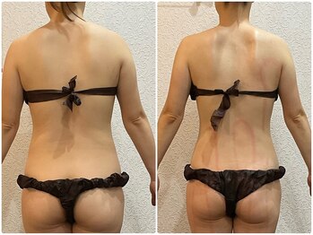 美容整体ウェリナ 中川八田院/小顔矯正/骨盤矯正/痩身整体