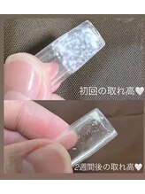 ヨルエステ(yoru aesthe)/【毛穴洗浄コース】