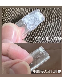 ヨルエステ(yoru aesthe)/【毛穴洗浄コース】