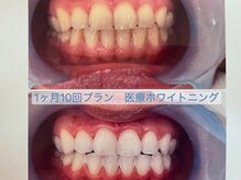 シャイニー 掛川店(shiny)/