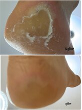 ラヴィ(La vie)/剥いたらガチガチに