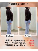 くさば整骨院/45歳女性/ダイエット3か月コース