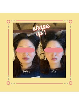 美容整体サロン プライム(Prime)/小顔矯正　ビフォーアフター