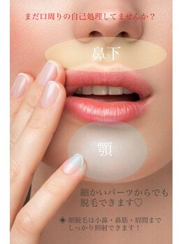 スウィート 刈谷店(Sweet)/パーツ脱毛