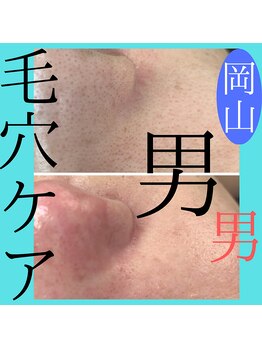 サロンこころ/1回でこの効果！毛穴ケア