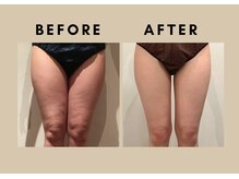 バウト(VAUT)/before/after