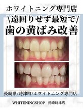 ホワイトニングショップ 長崎時津店/白い歯を目指して★