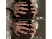 至福のあくび/小顔効果やリフトアップ効果も！