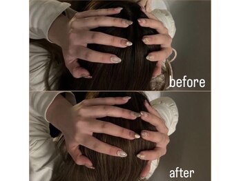 至福のあくび/小顔効果やリフトアップ効果も！