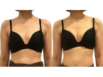 ユーティ(YOUTY)/２カップUPの方、続出中！