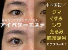 ショコラッシュ(Shocolash)