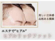 ベラ 東京院(Bella)の雰囲気（年々減るボリュームが印象を左右するから、足すケアが若見えの鍵）