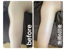 ギンザアール(GINZA R.)の雰囲気（丁寧なカウンセリングで貴女にあった施術を提案♪）