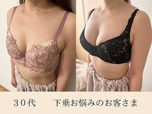 ラーナ(Lana)/【バストアップ】症例♪
