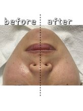 エクスクラメーションマーク(!!!)/片側のみ照射！