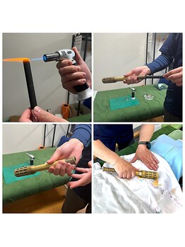 村田治療院/棒灸を使った温灸です。