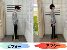 おいかわ整骨院/猫背矯正