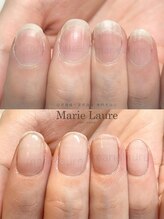 マリーロール 梅田店(Marie Laure)/自爪育成/深爪矯正/ネイルケア