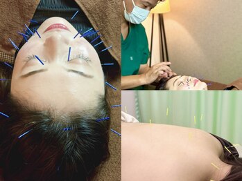 京 鍼灸院 整体院の写真/《鍼灸・美容鍼灸・整体・カッピング》鍼施術が初めての方も大歓迎♪お身体の状態に合わせた施術をご提案◎