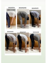 アクア∞リング/ビフォーアフター約2年半