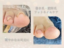 ニコワイズネイル(Nico Y's Nail)の雰囲気（巻き爪ケアもお任せ下さい！平均1～3回で改善！）
