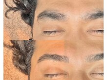 リリー(Lily)/【WAX脱毛】