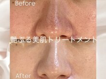 ラリュンヌ(La Lune)